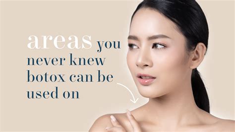 Areas You Never Knew Botox Can Be Used On Mizu Aesthetic Clinic