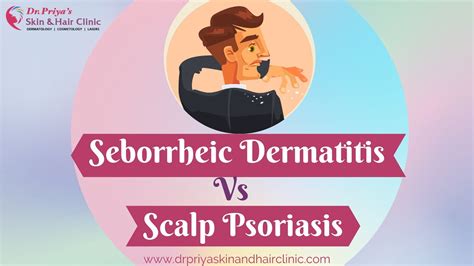 Scalp Psoriasis Vs Seborrheic Dermatitis Best Dermatologist In