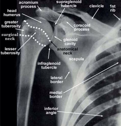 It separates the 2nd (ecrb and ecrl) and 3rd (epl) extensor compartments. AP of the glenohumeral joint | Medical anatomy, Radiology ...