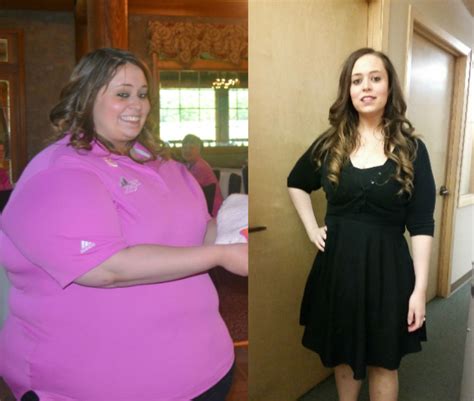 Collection Pictures Female Weight Gain Before And After Pictures Completed