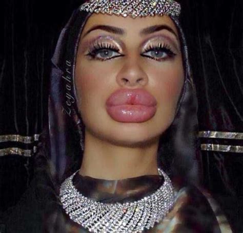 World Record Breaker She Has The Biggest Lips In The World Demotix