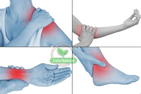 Tendinite O Que é Causas Sintomas E Tratamentos Cura Natural