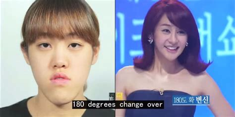 This South Korean Plastic Surgery Makeover Show Is The Craziest