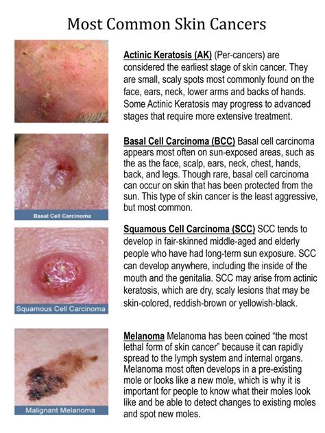 Different Types Of Skin Cancer Cells
