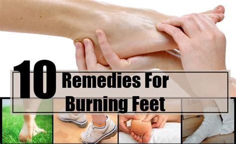 10 Home Remedies For Burning Feet Home Remedies Remedies Foot Remedies