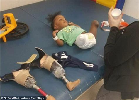 Boy 2 Walks With Prosthetic Legs After Double Amputation Daily Mail