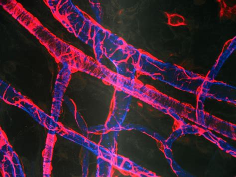 Scientists Can Now 3d Print Blood Vessels