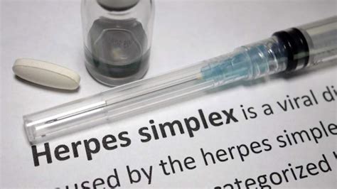 10 Ways To Prevent Herpes Outbreaks Genital Herpes Healthcentral