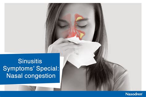 Sinusitis Symptoms Specialnasal Congestion