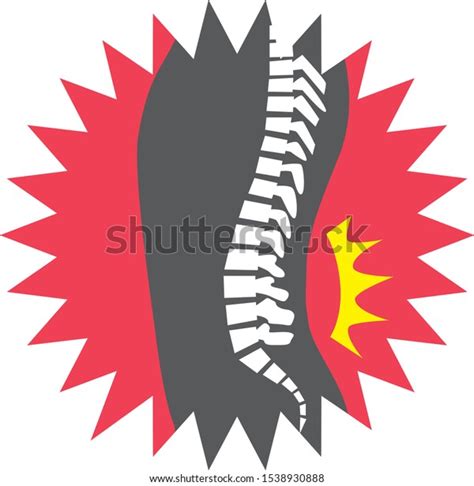 Illustration Inspired By Man Back Pain Stock Vector Royalty Free