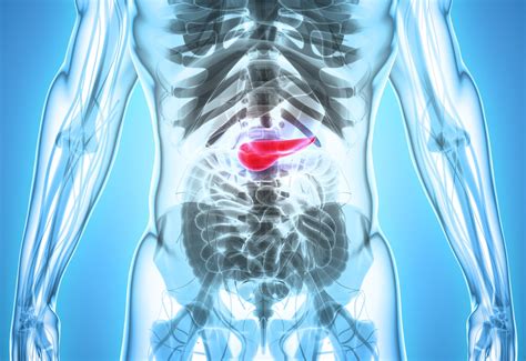 Improving Survival In Pancreatic Cancer With Platinum Based Chemotherapy