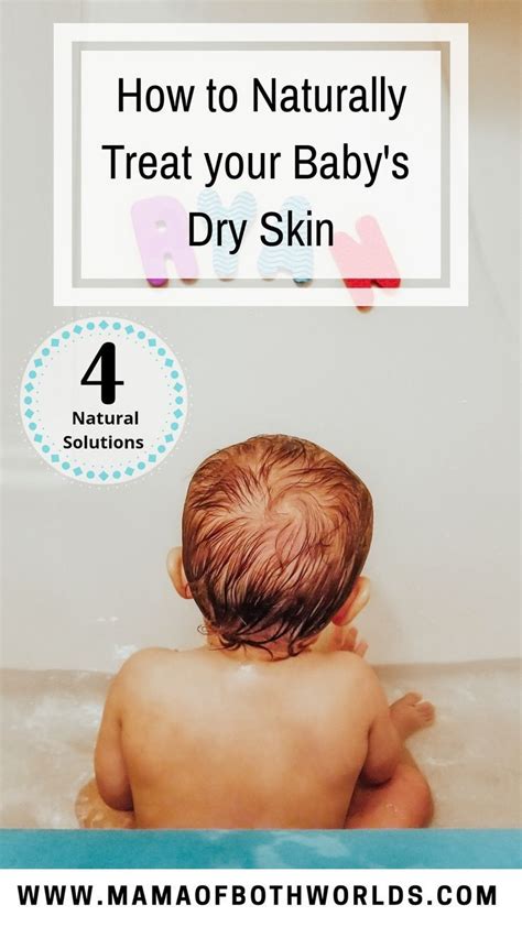 Natural Ways To Treat Your Babys Dry Skin Mama Of Both Worlds In