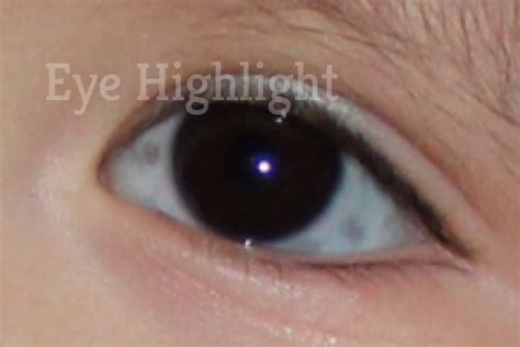 How To Remove Dark Grey Black And Brown Spot On Sclera Eyeball 2022