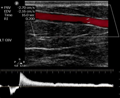 Venous Ultrasound Hands On Training Registered Vascular Solutions