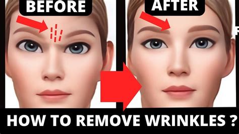 How To Get Rid Of Wrinkles How To Get Rid Wrinkles Between The