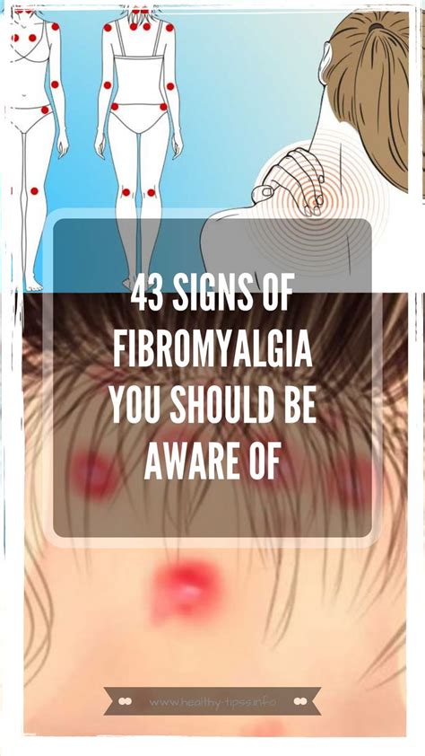 43 Signs Of Fibromyalgia You Should Be Aware Of Fibromyalgia What