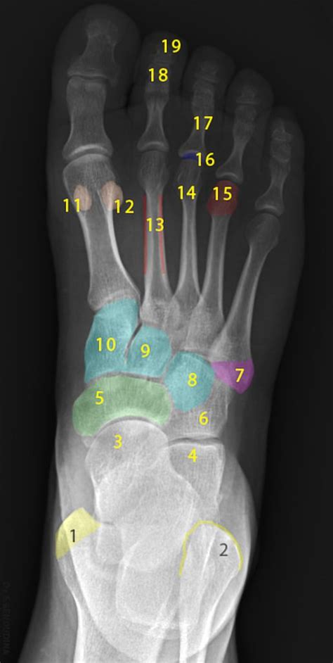 Pin On Radiologijaradiologyradiologie