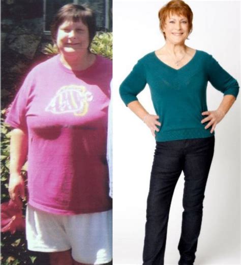 Weight loss can often feel like an uphill battle. Amazing Weight Loss: Before and After (30 pics) - Izismile.com