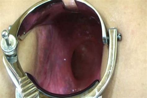 metal speculum stretches my wife s loose asshole video