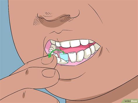 Wisdom tooth extraction may be done by a dentist or an oral surgeon. How to Pull Out a Loose Tooth | Loose tooth, Loose teeth ...