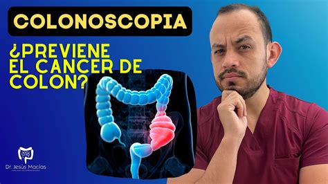 Colonoscopia Y Cáncer De Colorrectal Dr Juan Pablo Hernández Parte Final Youtube