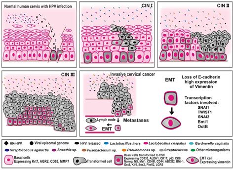 Cervical Cancer Stem Cells And Other Leading Factors Associated With