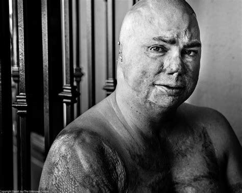 Everyone Should See These Powerful Images Of Wounded Vets We Are The Mighty