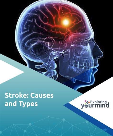 Stroke Causes And Types Teaching Biology Technology Life