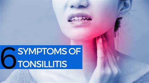 Ppt 6 Symptoms Of Tonsillitis Powerpoint Presentation Free Download