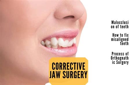 Corrective Jaw Surgery Angel Orthodontics