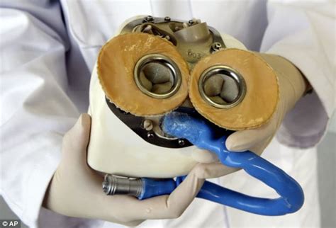 Worlds First Artificial Heart Transplant Performed In France Daily