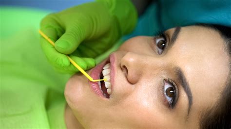 Woodland Hills Dentist Fixes Chipped Teeth With Dental Bonding