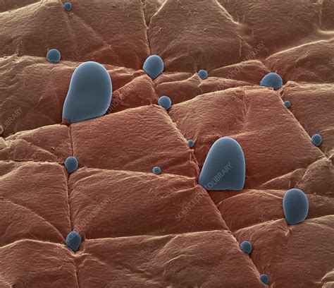 Skin Surface Sem Stock Image C0178494 Science Photo Library