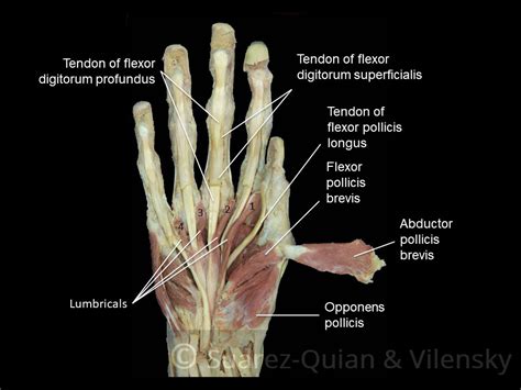 Name Of Muscles In Hand Keyboard Hand Musclesinterossei Lumbricales