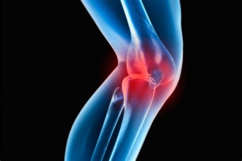 dolor de rodillas al flexionar causas y tratamiento la guía de las vitaminas