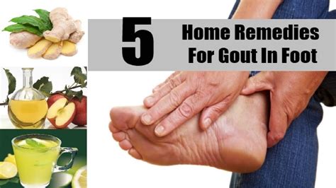 5 Natural Gout Home Remedies And Treatments Prevention Home