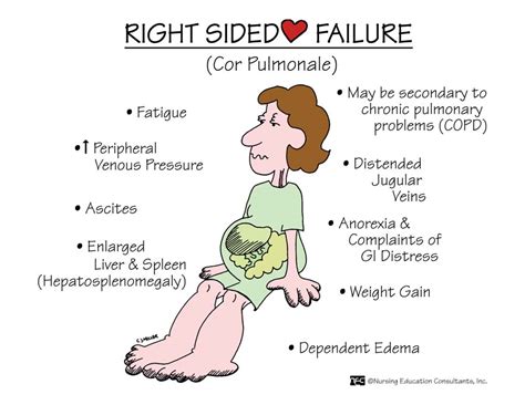 Right Sided Heart Failure Nur102 04939fundamentals Of Nursing