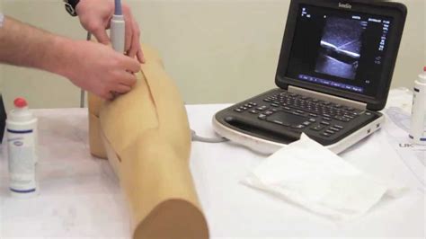 Ultrasound Guided Femoral Arterial Access Youtube