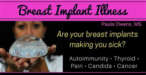 Breast Implant Illness Are They Making You Sick Paula Owens Ms