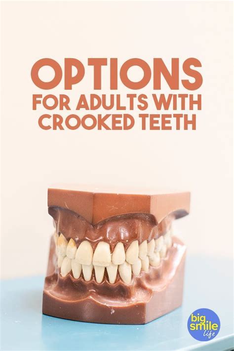 Can i fix my uneven teeth without metal braces? Options for adults with crooked teeth. It's never too late ...