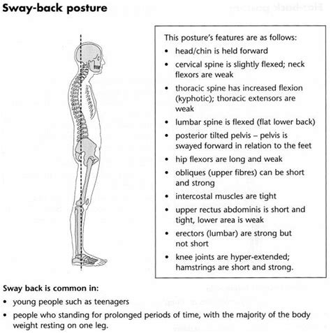 What Posture Type Are You Sore Hips Hip Flexor Exercises Hip Flexor