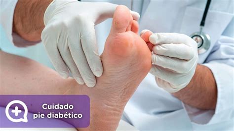 Cuidado del pie diabético mediQuo