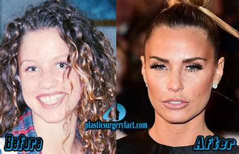 Jun 11, 2021 · katie price is reportedly set to shell out a whopping £12,000 when she heads to turkey to go under the knife in her latest surgery transformation. Katie Price Plastic Surgery | Katie Price Before and After ...