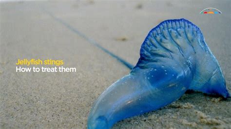 Jellyfish Stings How To Treat Them Youtube