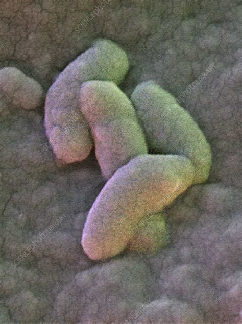 Campylobacter Jejuni Bacteria SEM Stock Image B220 1206 Science