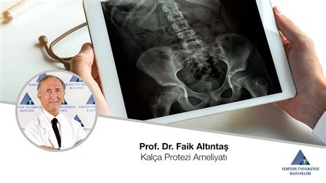 Kalça Protezi Ameliyatı Prof Dr Faik Altıntaş Youtube