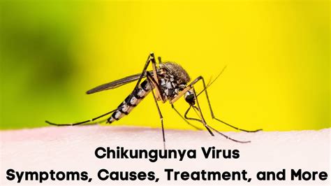 What Is Chikungunya Symptoms Causes Treatment And Prevention