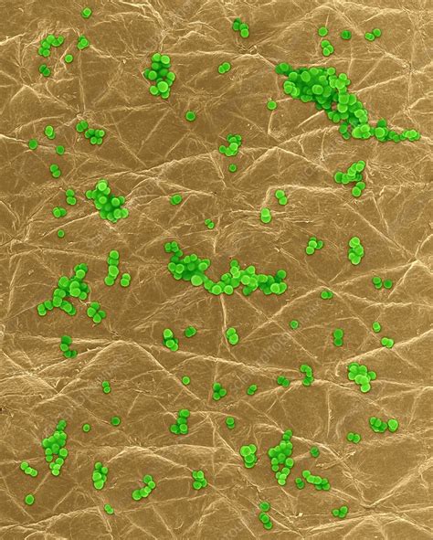 Staphylococcus Aureus On Human Skin Sem Stock Image C0321940