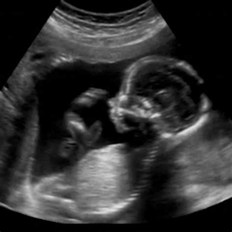 13 ssw schwangerschaftswoche größe entwicklung and mehr