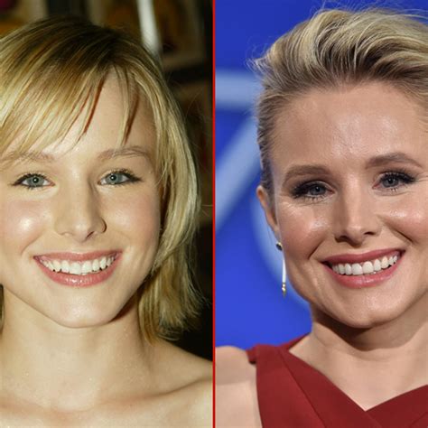 Did Kristen Bell Get A Boob Job